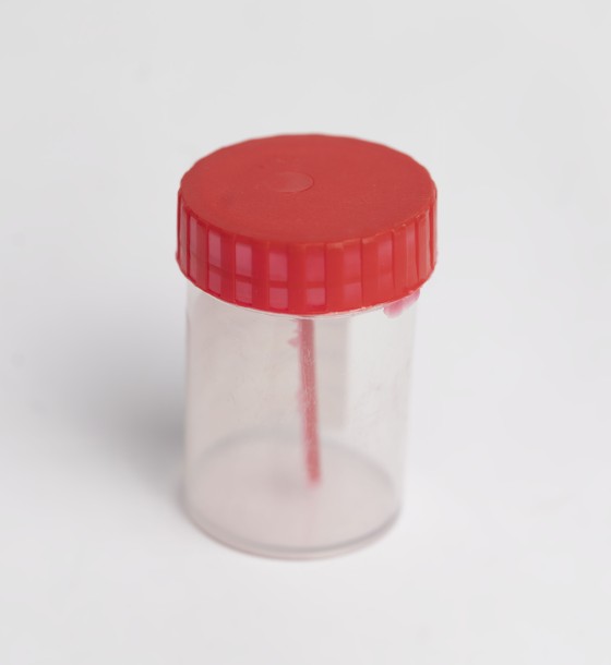 غطاء للمواد الحيوية مع ملعقة، غير معقم، قابل للتصرف 60 مل urine