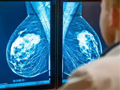 تعرف على كل التفاصيل حول العلاج بالحجامة